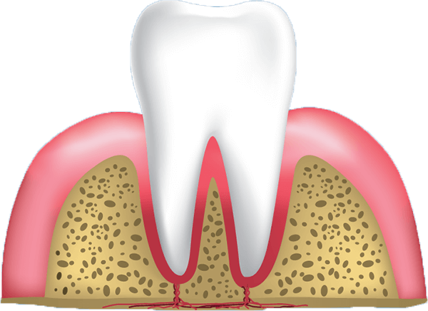 tooth root 3d model