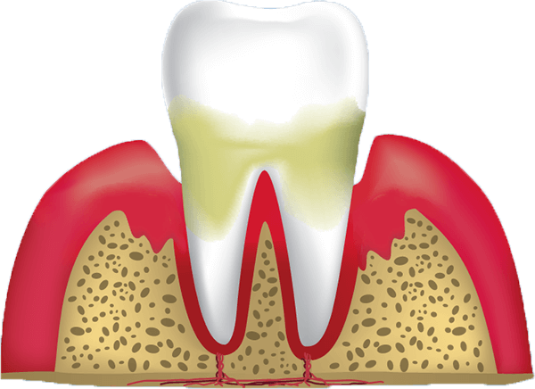 tooth root 3d model