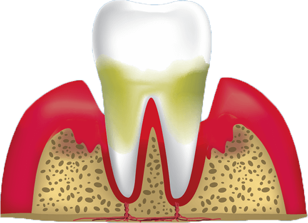 tooth root 3d models