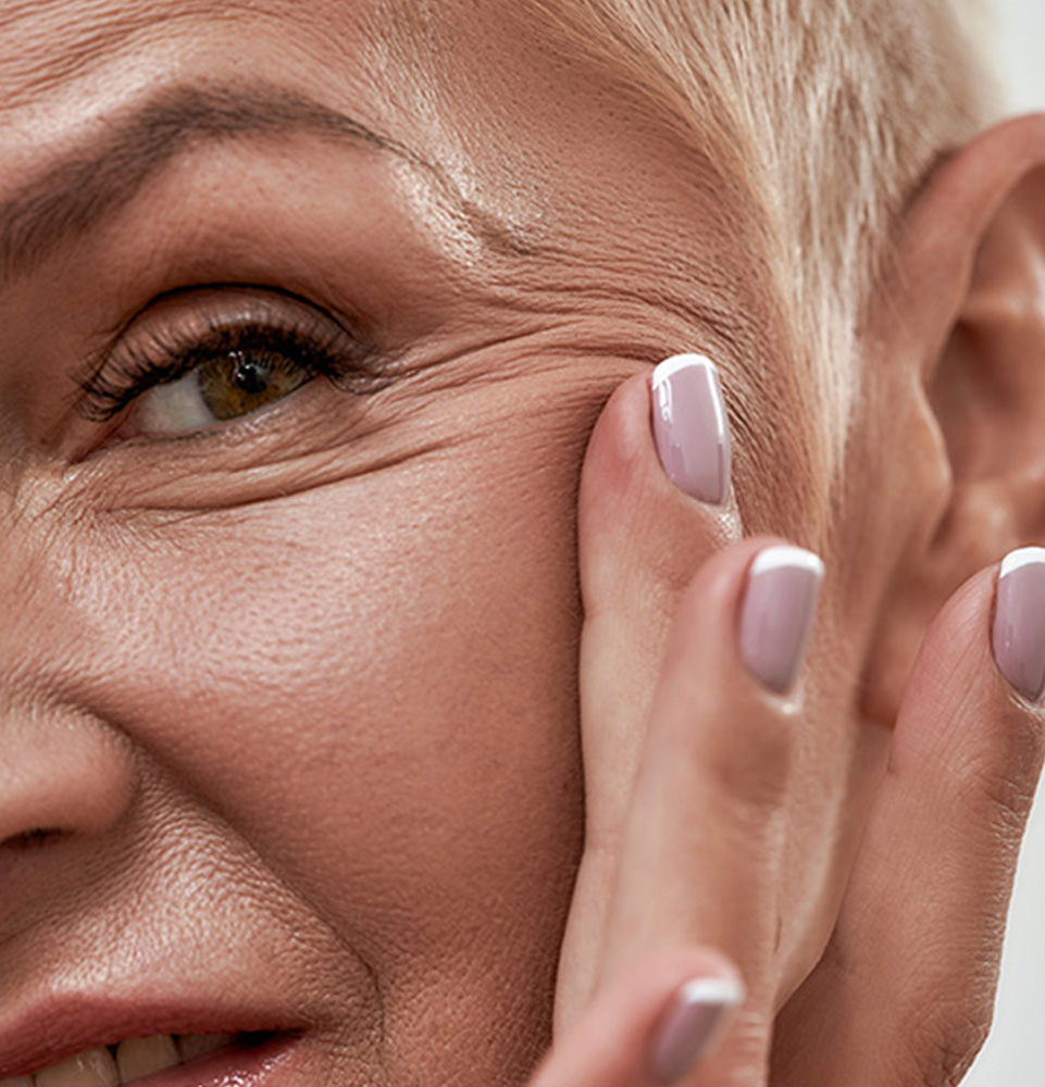 woman showing wrinkles on her skin