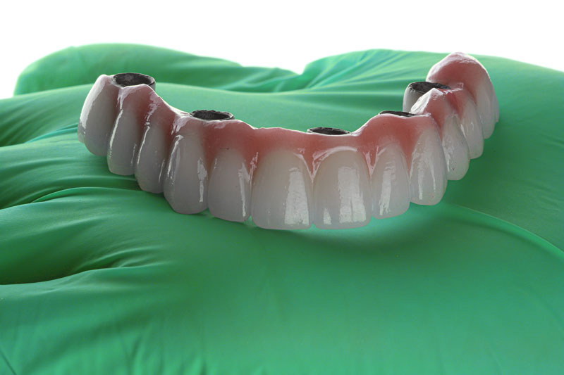 Discover the Transformative Power of Snap In Dentures | Dentistry in Provo, UT